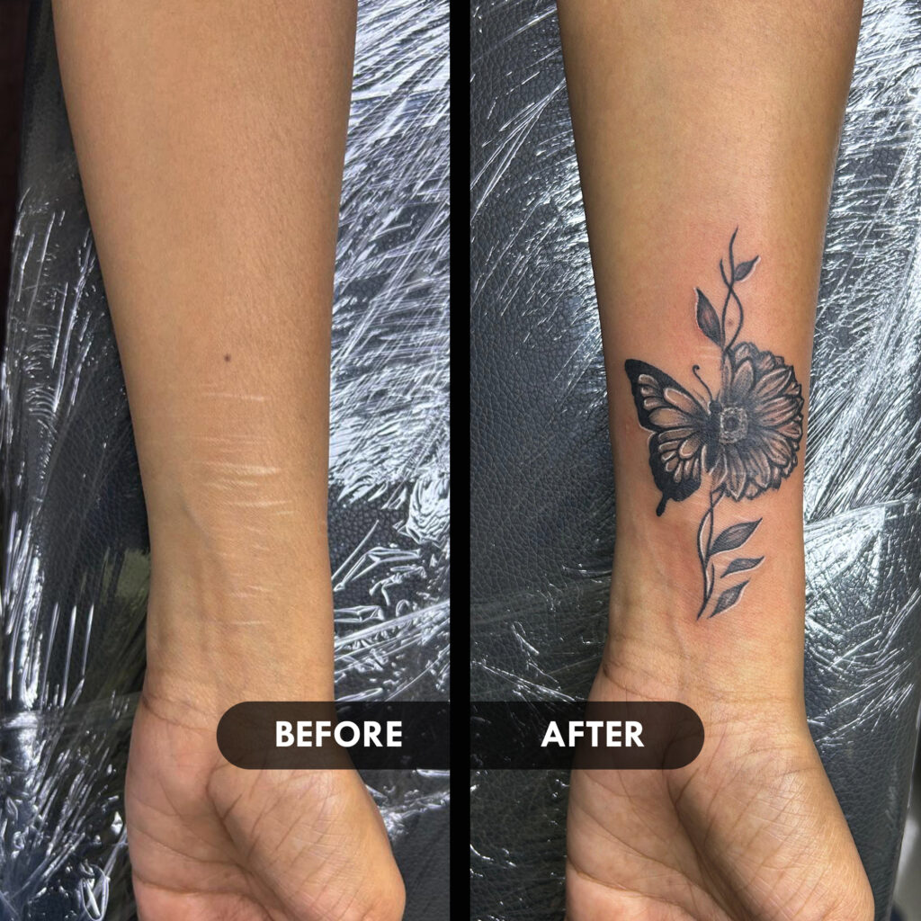 Scar cover-up tattoos, Cover-up tattoos